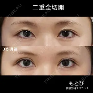 もとび美容外科クリニック 新宿院 西尾 謙三郎医師の症例