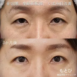もとび美容外科クリニック 新宿院 西尾 謙三郎医師の症例