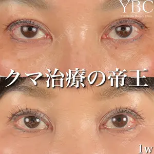 YBC横浜美容外科 大宮院 磯村 亮輔医師の症例