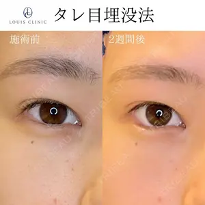 LOUIS CLINIC 二子玉川院【ルイクリニック】 小松 塁医師の症例