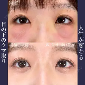 ネビュラクリニック 広島院の症例