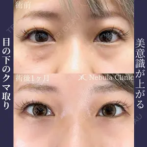 ネビュラクリニック 広島院の症例