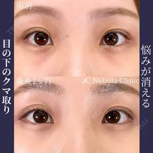 ネビュラクリニック 広島院の症例