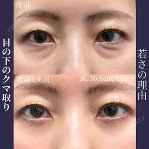 ネビュラクリニック 広島院の症例