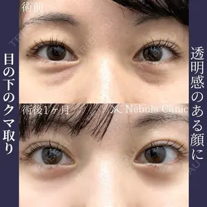 ネビュラクリニック 広島院の症例