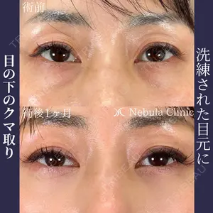 ネビュラクリニック 広島院の症例