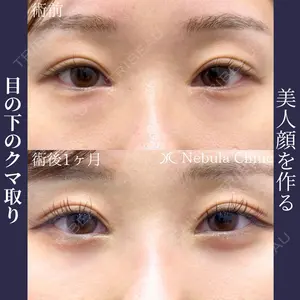 ネビュラクリニック 広島院の症例