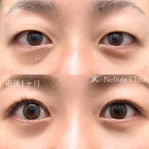 ネビュラクリニック 広島院の症例