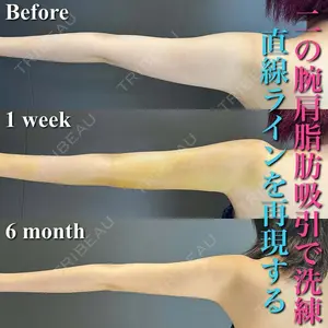 AVAN TOKYO 銀座脂肪吸引 クリニック 森脇 進医師の症例