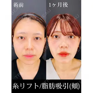 HAAB×DREAM BEAUTY CLINIC 大阪梅田院 鈴木 馨斗医師の症例