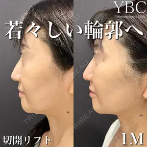 YBC横浜美容外科 大宮院 磯村 亮輔医師の症例