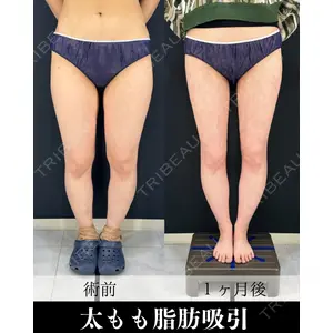 HAAB×DREAM BEAUTY CLINIC 東京本院 吉岡 修一医師の症例