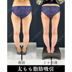 HAAB×DREAM BEAUTY CLINIC 東京本院 吉岡 修一医師の症例
