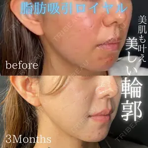 THE FIRST CLINIC 多摩センター院 惟村 公郁医師の症例