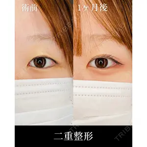 HAAB×DREAM BEAUTY CLINIC 大阪梅田院 柏木 太雅医師の症例