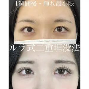 ルラ美容クリニック 渋谷本院の症例