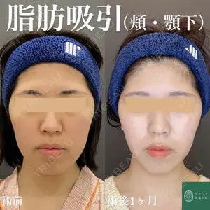 オアシス美容外科 遠藤 剛史医師の症例