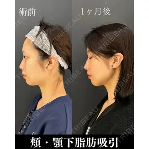 HAAB×DREAM BEAUTY CLINIC 東京本院 吉岡 修一医師の症例
