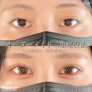 Brandnew Beauty Clinicの症例