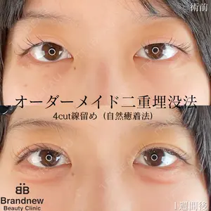 Brandnew Beauty Clinicの症例