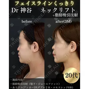 EMMO FACE CLINIC 大阪梅田院 神谷 一成医師の症例