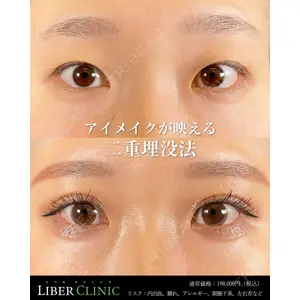 LIBER CLINICの症例