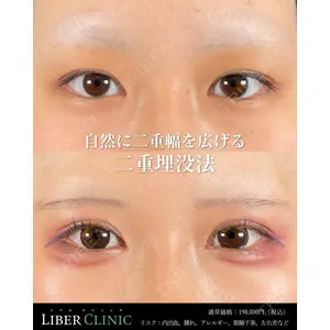 LIBER CLINICの症例