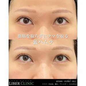 LIBER CLINICの症例