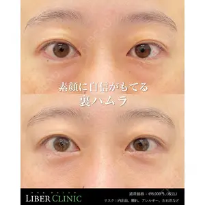 LIBER CLINICの症例