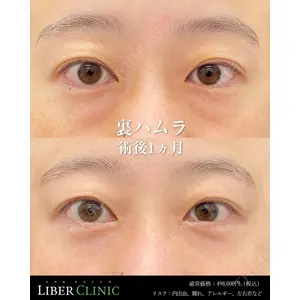 LIBER CLINICの症例