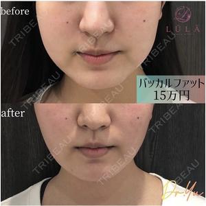 ルラ美容クリニック 仙台院 / ルラスキンクリニック 仙台院の症例