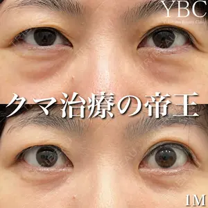 YBC横浜美容外科 立川院の症例