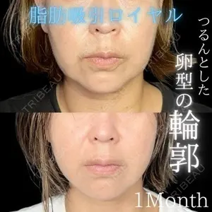 THE FIRST CLINIC 多摩センター院 惟村 公郁医師の症例