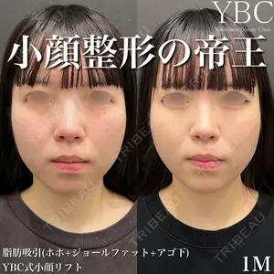 YBC横浜美容外科 大宮院 磯村 亮輔医師の症例