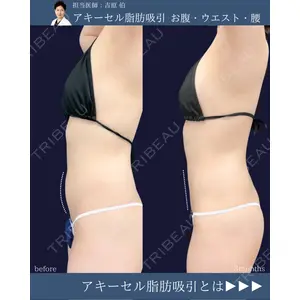 東京シンデレラ美容外科 新宿院 吉原 伯医師の症例