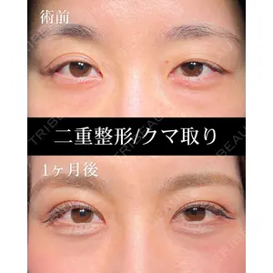 HAAB BEAUTY CLINIC 名古屋院 丸山 舜大医師の症例
