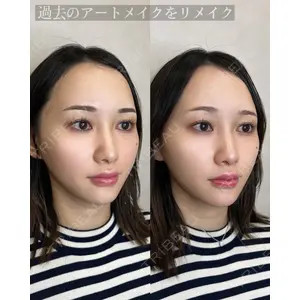 インクリニック 大塚 はるか医師の症例