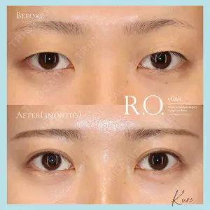 R.O.clinic 黒田 大樹医師の症例