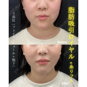 THE FIRST CLINIC 町田院 木暮 啓一郎医師の症例