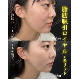 THE FIRST CLINIC 町田院 木暮 啓一郎医師の症例
