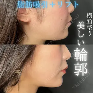 THE FIRST CLINIC 多摩センター院 惟村 公郁医師の症例