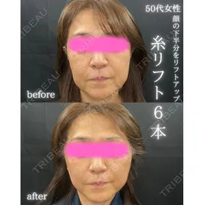 THE FIRST CLINIC 町田院 木暮 啓一郎医師の症例