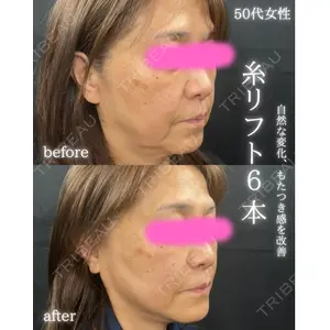 THE FIRST CLINIC 町田院 木暮 啓一郎医師の症例