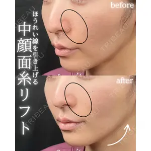 THE FIRST CLINIC 町田院 木暮 啓一郎医師の症例