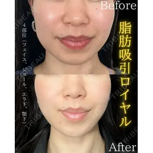 THE FIRST CLINIC 町田院 木暮 啓一郎医師の症例