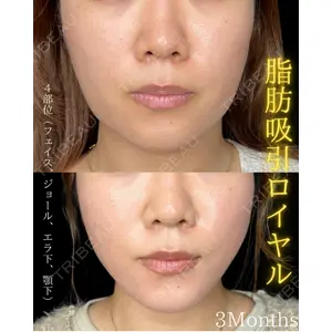 THE FIRST CLINIC 町田院 木暮 啓一郎医師の症例