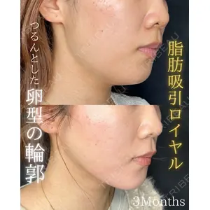 THE FIRST CLINIC 町田院 木暮 啓一郎医師の症例