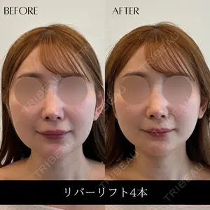 RIVER CLINIC（リバークリニック）の症例