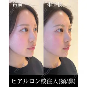 HAAB×DREAM BEAUTY CLINIC 東京本院 佐野 圭医師の症例