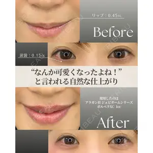 APスキンクリニック銀座 高麗 惠理医師の症例